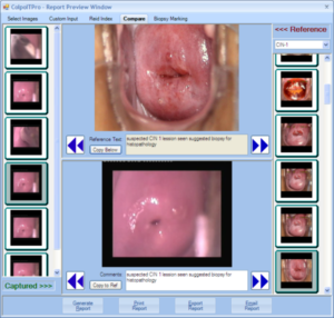 imagecomparision 600x572